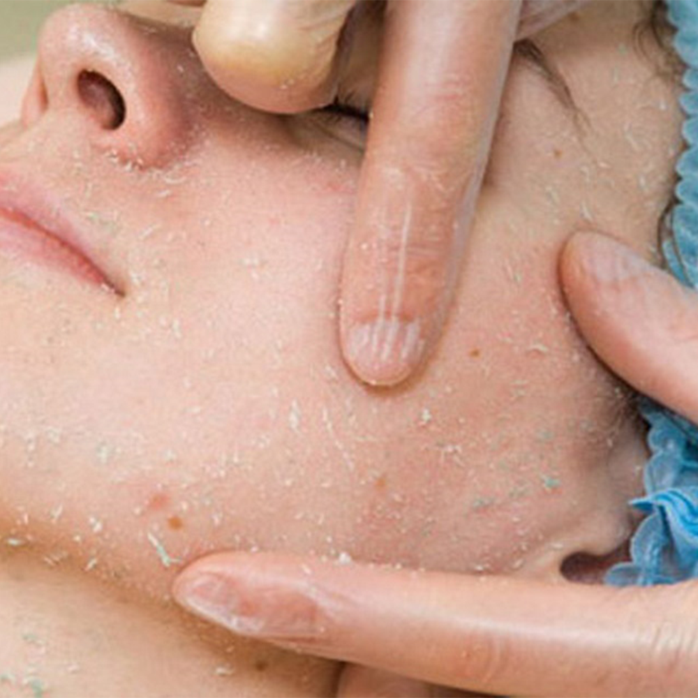Thera Esthetique Grossiste En Produit Esthetique Bretagne Technologies Minceur